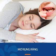 Giải mã giấc mơ rụng răng – mơ gãy răng đánh đề con gì?